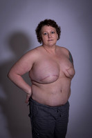 Jodi M - Breast reconstruction phase 2